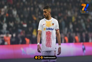 موج تازه مصدومیت‌ها؛ نگرانی درباره وضعیت مدافع ایرانی!